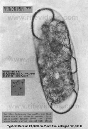 Rife Typhoid Bacillus